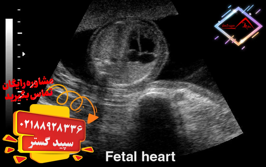 بهترین زمان سونوگرافی برای ضربان قلب جنین