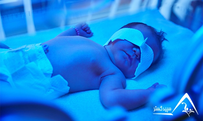 سریع ترین راه درمان زردی نوزاد